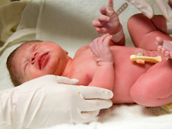 Cutting Of The Umbilical Cord Stock Photo - Download Image Now
